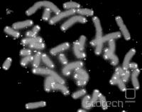 Kromosomi s telomerami v belem