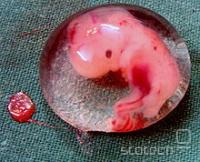  embrio