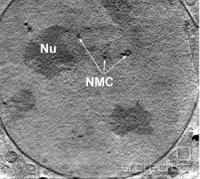 Posnetek celice adenokarcinoma. Vidna sta jedrce (NU) in membranski kanali skozi jedro (NMC).