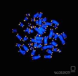 Telomere na koncih kromosomov so obarvane svetlo.