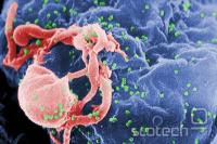 HIV napda celico (umetno obarvanje)